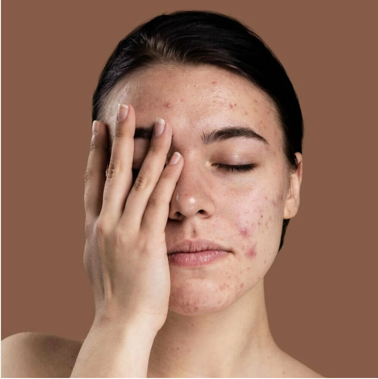 Проблемы с весом - симптом №3